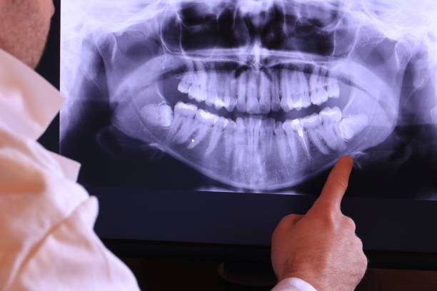 Best Emergency Tooth Extraction in White Oak, MS