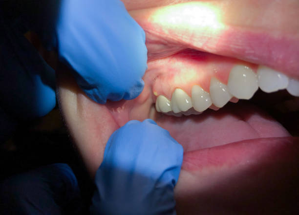 Best Emergency Treatment for Toothache in White Oak, MS